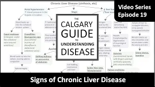 Signs of chronic liver disease