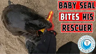 Baby Seal Bites His Rescuer