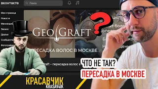 Блог о пересадке волос: про ГеоГрафт (GeoGraft) и E-max. С чего все начиналось?  KRASAV4IK