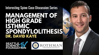 Case Discussions on Management of High Grade Isthmic Spondylolisthesis - Rothman Orthopedics