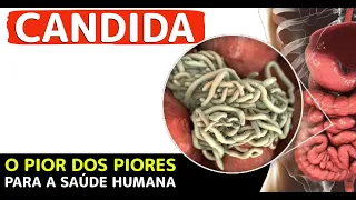 CANDIDA O PIOR DOS PIORES PARA A SAÚDE HUMANA  Dra. Luciana Fontes | Fernando Beteti