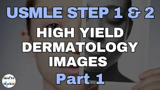 High Yield Dermatology Images | USMLE/Step 1/Step 2/COMLEX (part 1)
