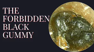 The Forbidden Black  Gummy