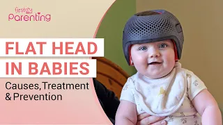 Flat Head in Babies (Plagiocephaly) -  Should Be Worried?