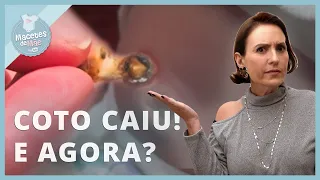 Cuidados OBRIGATÓRIOS depois que o COTO CAIR! | MACETES DE MÃE