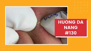 #130 | Huong Da Nang