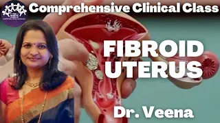 Fibroid Uterus - OBG Clinical Case presentation