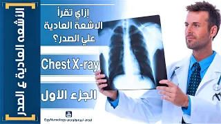 إزاي تقرأ الاشعه العادية علي الصدر؟ | (Chest X-ray) الجزء الاول