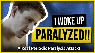 I woke up Paralyzed! A real hypokalemic periodic paralysis attack.