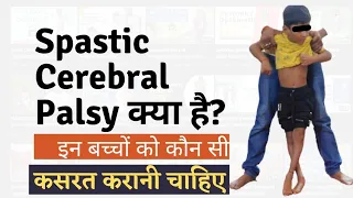 Spastic Cerebral Palsy | Types of Spastic CP | Symptom of Spastic CP | Treatment of Spastic CP