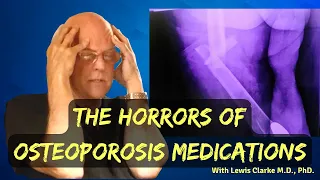 What They Aren't Telling You About Osteoporosis Medication