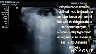 subcutaneous abscess | ultrasound case