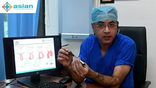 General Awareness about Appendicitis || Dr Pankaj Kumar Hans || Asian Hospital