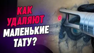 Татушки-малышки исчезают на глазах! | Лучший лазер Москвы против маленьких татуировок