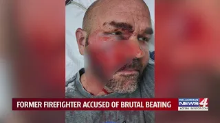 Oklahoma man says he was attacked, knocked out after asking neighbors to keep noise down