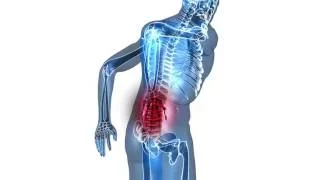 Back Pain Linked to Knee Pain