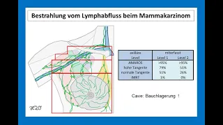 Bestrahlung vom Lymphabflussgebiet beim Mammakarzinom | Strahlentherapie Prof. Hilke Vorwerk