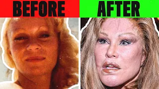 10 People Who Took Plastic Surgery TOO Far…