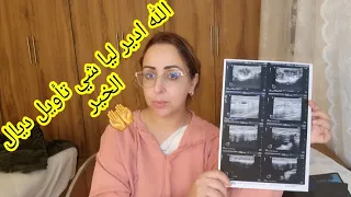 صدمني الطبيب⛔️نتيجة السكانير والتحاليل ❌️