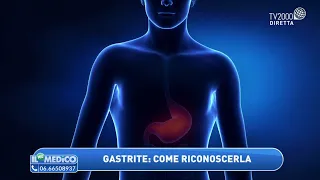 Gastrite: come riconoscerla. Bruciori di stomaco: cosa fare? Cosa evitare a tavola