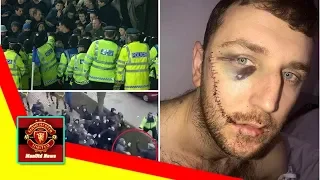 ManUtd News - Police condemn 'most shocking violence for some time' at Millwall vs Everton