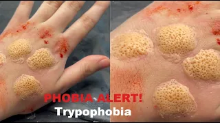 TRYPOPHOBIA SFX MAKEUP