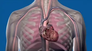 Как работает кардиостимулятор