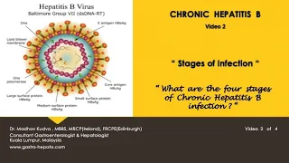 CHRONIC HEPATITIS B:STAGES OF INFECTION