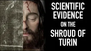 Scientific Evidence on the Shroud of Turin