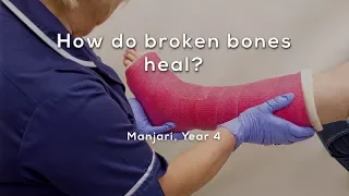 How do broken bones heal?