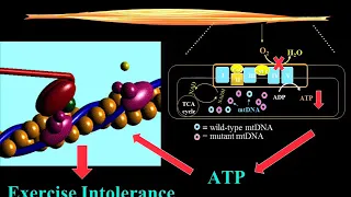 Exercise and the Mitochondrial Disease Patient