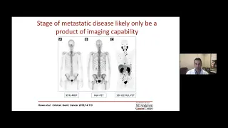 Weill Cornell Urology - Grand Rounds: Dr. Brian F. Chapin