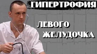 Гипертрофия левого желудочка | Лечение