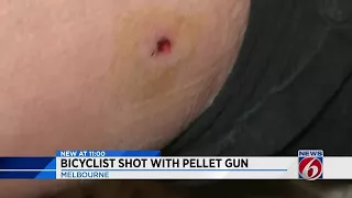 Bicyclist shot with pellet gun