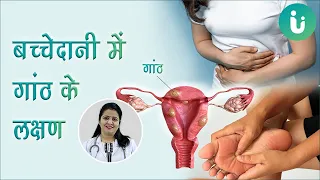 गर्भाशय या बच्चेदानी में गांठ, रसौली या फाइब्रॉएड के लक्षण - Uterus me rasoli ya fibroid ke lakshan