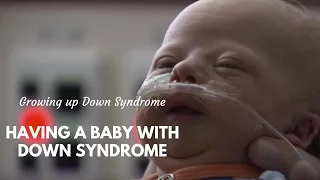 Raising a baby with Down Syndrome
