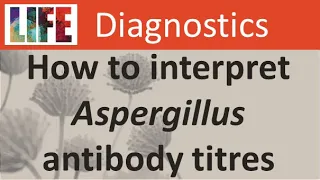 How to interpret Aspergillus antibody (IgG) titres for chronic aspergillosis