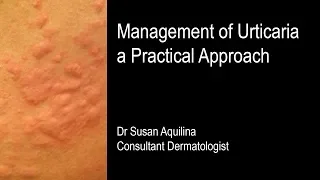 Management of Urticaria: a Practical Approach