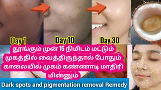 இதுவரை யாரும் சொல்லாத ஒரு சூப்பர் remedy🛑No Darkspots/❌No Pigmentation/✨get clear skin tone everyday