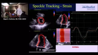 Regional Wall Motion and Stress Echocardiography (Miguel Quiñones, M.D.) December 8, 2016