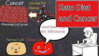 Ketogenic Diet for Cancer: Treatment and Prevention