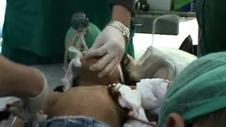 Misrata War Injuried Child