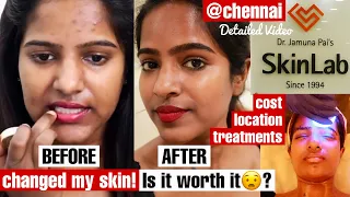 UNSPONSORED TRUTH about my skin❤️What I did?Watch this before going to SkinLab For Skin Treatment