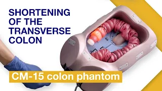 Exercise 4: Shortening of the transverse colon