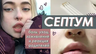 история одного септума