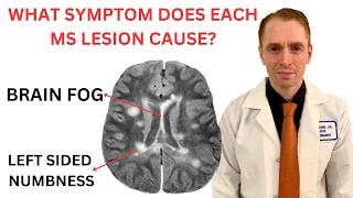 What Symptom Does Each Multiple Sclerosis MRI Lesion Cause?  Neurologist Explains