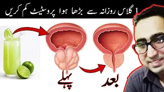 Drink 1 Cup EVERYDAY To Shrink An ENLARGED Prostate | BPH - Dr Javaid Khan