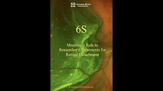 Retinal Detachment. 6S, Mnemonic Rule to Remember 6 Treatments. #retinaldetachment