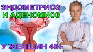 Эндометриоз и Аденомиоз у женщин 40+. Что делать? Гинеколог Екатерина Волкова