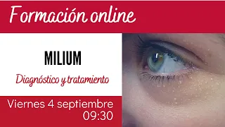 Milium. Diagnóstico y tratamiento.